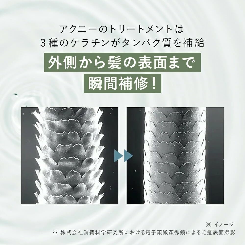 Amazon | AKNIR アクニー 薬用ヘアトリートメント 300g ダメージ補修